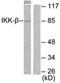 Inhibitor Of Nuclear Factor Kappa B Kinase Subunit Beta antibody, LS-C117618, Lifespan Biosciences, Western Blot image 