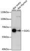 Serum/Glucocorticoid Regulated Kinase 1 antibody, GTX54726, GeneTex, Western Blot image 