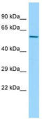 Chaperonin Containing TCP1 Subunit 6A antibody, TA332133, Origene, Western Blot image 