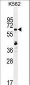Zinc Finger Protein 619 antibody, LS-C160917, Lifespan Biosciences, Western Blot image 