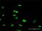 Forkhead Box P2 antibody, H00093986-M02, Novus Biologicals, Immunocytochemistry image 