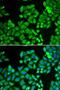 Protein Phosphatase 4 Catalytic Subunit antibody, LS-C748577, Lifespan Biosciences, Immunofluorescence image 