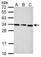 Proteasome activator complex subunit 3 antibody, GTX106722, GeneTex, Western Blot image 