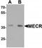 Mitochondrial Trans-2-Enoyl-CoA Reductase antibody, TA319915, Origene, Western Blot image 