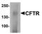 CF Transmembrane Conductance Regulator antibody, A00028, Boster Biological Technology, Western Blot image 