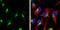 Lysosomal Associated Membrane Protein 1 antibody, GTX634336, GeneTex, Immunofluorescence image 