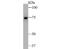 Ribosomal Protein S6 Kinase A1 antibody, NBP2-80423, Novus Biologicals, Western Blot image 