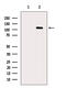 5'-3' Exoribonuclease 2 antibody, GTX01072, GeneTex, Western Blot image 