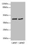 Mitochondrial Carrier 1 antibody, LS-C676081, Lifespan Biosciences, Western Blot image 