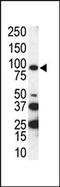 AXL Receptor Tyrosine Kinase antibody, 63-030, ProSci, Western Blot image 