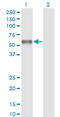 Protein C, Inactivator Of Coagulation Factors Va And VIIIa antibody, LS-C198006, Lifespan Biosciences, Western Blot image 