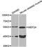 Myocyte Enhancer Factor 2A antibody, MBS9128532, MyBioSource, Western Blot image 