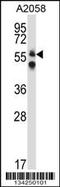 Dihydropyrimidinase Like 3 antibody, MBS9213382, MyBioSource, Western Blot image 