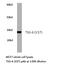 TNF Alpha Induced Protein 6 antibody, LS-C177123, Lifespan Biosciences, Western Blot image 