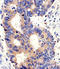 Proprotein Convertase Subtilisin/Kexin Type 9 antibody, LS-C100922, Lifespan Biosciences, Immunohistochemistry paraffin image 