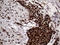 Transaldolase 1 antibody, LS-C795172, Lifespan Biosciences, Immunohistochemistry paraffin image 