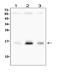 Baculoviral IAP repeat-containing protein 5 antibody, A00379, Boster Biological Technology, Western Blot image 