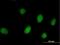 Rhox Homeobox Family Member 2 antibody, H00084528-B01P, Novus Biologicals, Immunofluorescence image 