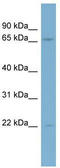 Kinesin Family Member 2B antibody, TA334742, Origene, Western Blot image 