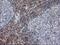 Phosphatidylinositol-5-Phosphate 4-Kinase Type 2 Alpha antibody, MA5-25383, Invitrogen Antibodies, Immunohistochemistry frozen image 