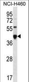 Carcinoembryonic Antigen Related Cell Adhesion Molecule 18 antibody, LS-C168644, Lifespan Biosciences, Western Blot image 