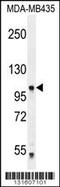 Protocadherin Alpha 5 antibody, 56-168, ProSci, Western Blot image 