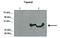 Tetraspanin 2 antibody, NBP1-59226, Novus Biologicals, Western Blot image 