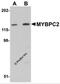 Myosin Binding Protein C, Fast Type antibody, 5651, ProSci Inc, Western Blot image 