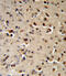 Tryptophan Hydroxylase 2 antibody, 63-822, ProSci, Immunohistochemistry paraffin image 