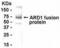 N(Alpha)-Acetyltransferase 10, NatA Catalytic Subunit antibody, XW-7676, ProSci, Western Blot image 