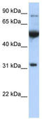 Eukaryotic Translation Initiation Factor 2B Subunit Alpha antibody, TA340021, Origene, Western Blot image 