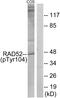 RAD52 Homolog, DNA Repair Protein antibody, PA5-38702, Invitrogen Antibodies, Western Blot image 