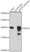 Rho Associated Coiled-Coil Containing Protein Kinase 1 antibody, GTX32843, GeneTex, Immunoprecipitation image 