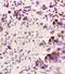 Colony Stimulating Factor 3 antibody, orb10702, Biorbyt, Immunohistochemistry paraffin image 