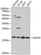 N(Alpha)-Acetyltransferase 50, NatE Catalytic Subunit antibody, 19-519, ProSci, Western Blot image 