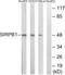 Signal Regulatory Protein Beta 1 antibody, PA5-39459, Invitrogen Antibodies, Western Blot image 