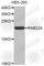 RAB22A, Member RAS Oncogene Family antibody, A3685, ABclonal Technology, Western Blot image 