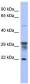 Phosphomannomutase 1 antibody, TA337686, Origene, Western Blot image 