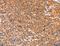 Adenosine Monophosphate Deaminase 1 antibody, LS-C402884, Lifespan Biosciences, Immunohistochemistry paraffin image 