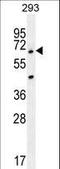 Ankyrin Repeat Domain 34B antibody, LS-C156349, Lifespan Biosciences, Western Blot image 