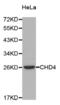 Chromodomain Helicase DNA Binding Protein 4 antibody, abx001824, Abbexa, Western Blot image 