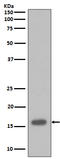 Cyclin-dependent kinase inhibitor 2A, isoforms 1/2/3 antibody, M00016, Boster Biological Technology, Western Blot image 