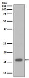 p16-INK4 antibody, M00016, Boster Biological Technology, Western Blot image 