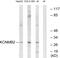 Potassium Calcium-Activated Channel Subfamily M Regulatory Beta Subunit 2 antibody, GTX87038, GeneTex, Western Blot image 