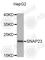 Synaptosome Associated Protein 23 antibody, A4249, ABclonal Technology, Western Blot image 