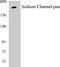 Sodium Voltage-Gated Channel Alpha Subunit 1 antibody, EKC1534, Boster Biological Technology, Western Blot image 