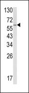 CTD Small Phosphatase 2 antibody, LS-C162901, Lifespan Biosciences, Western Blot image 