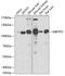 Membrane Bound Transcription Factor Peptidase, Site 1 antibody, GTX32714, GeneTex, Western Blot image 