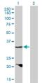 Cyclin D2 antibody, H00000894-D01P, Novus Biologicals, Western Blot image 