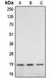 Caspase 2 antibody, LS-C351904, Lifespan Biosciences, Western Blot image 